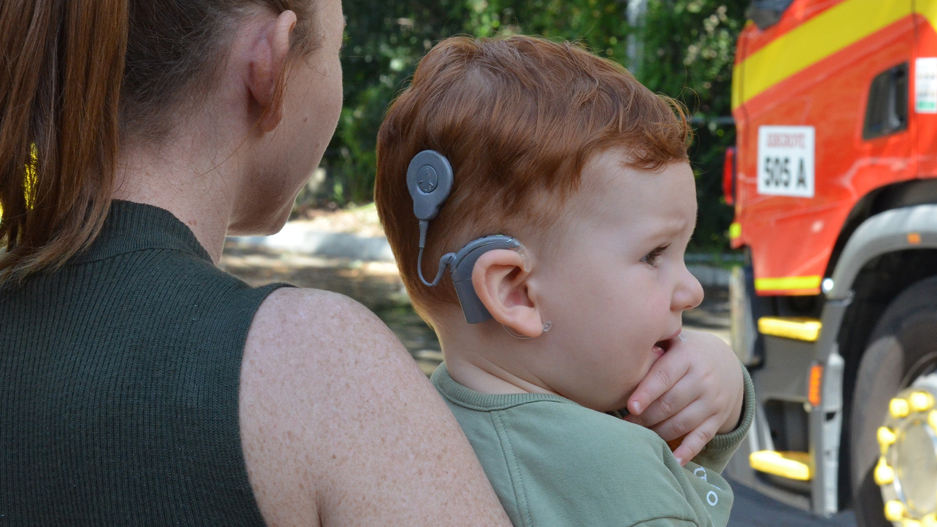 cochlear implant children
