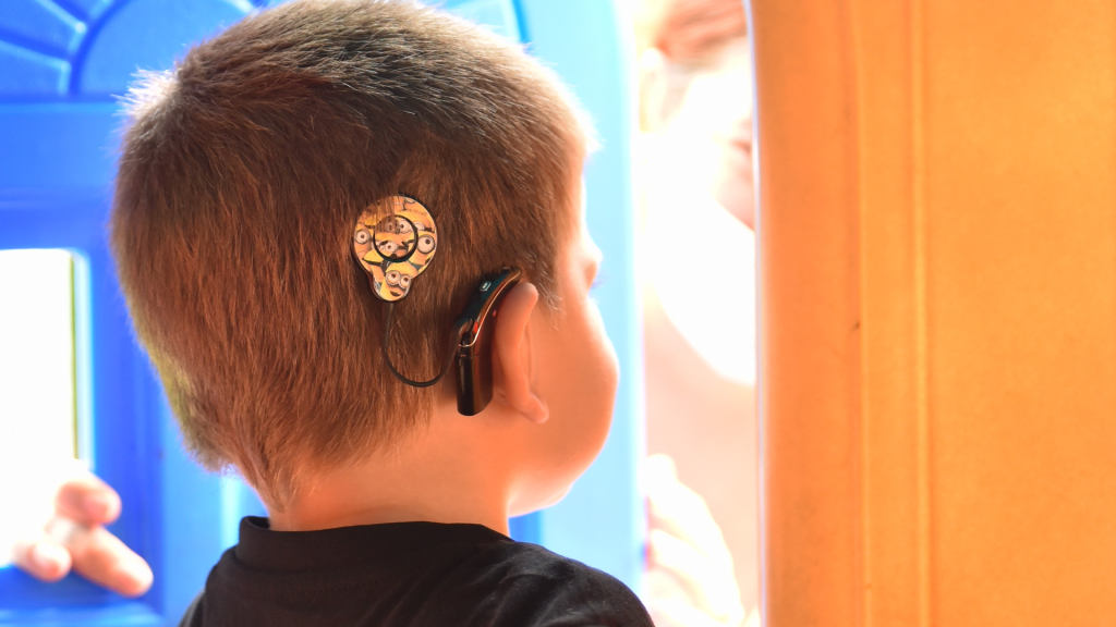 Back of boy with cochlear implant’s head.
