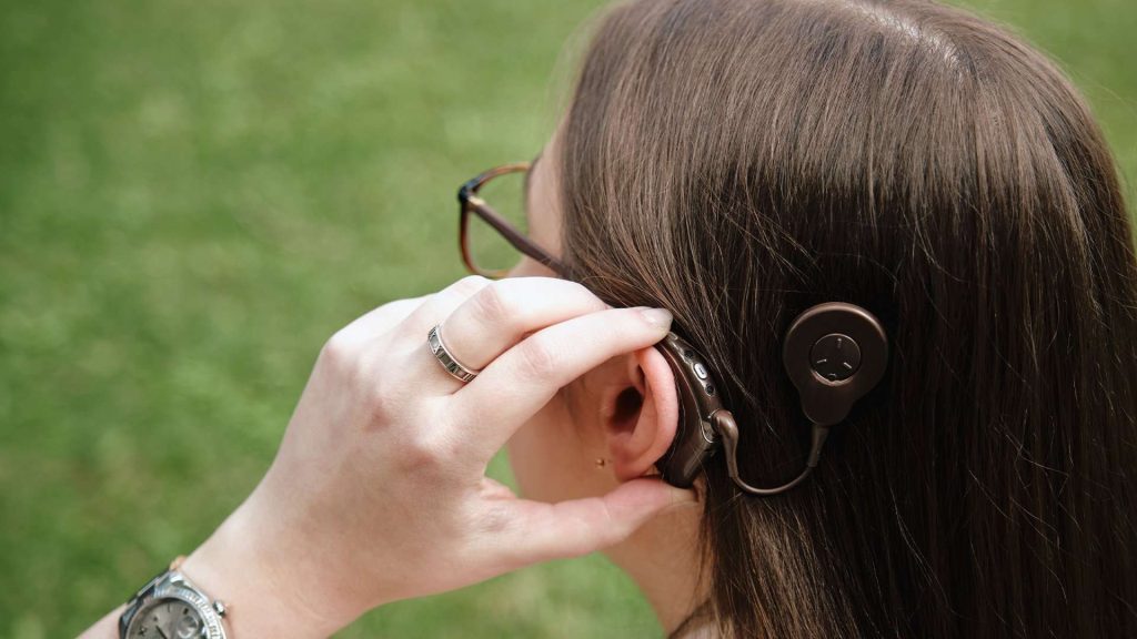 Back Of Women's Head With Cochlear Implant